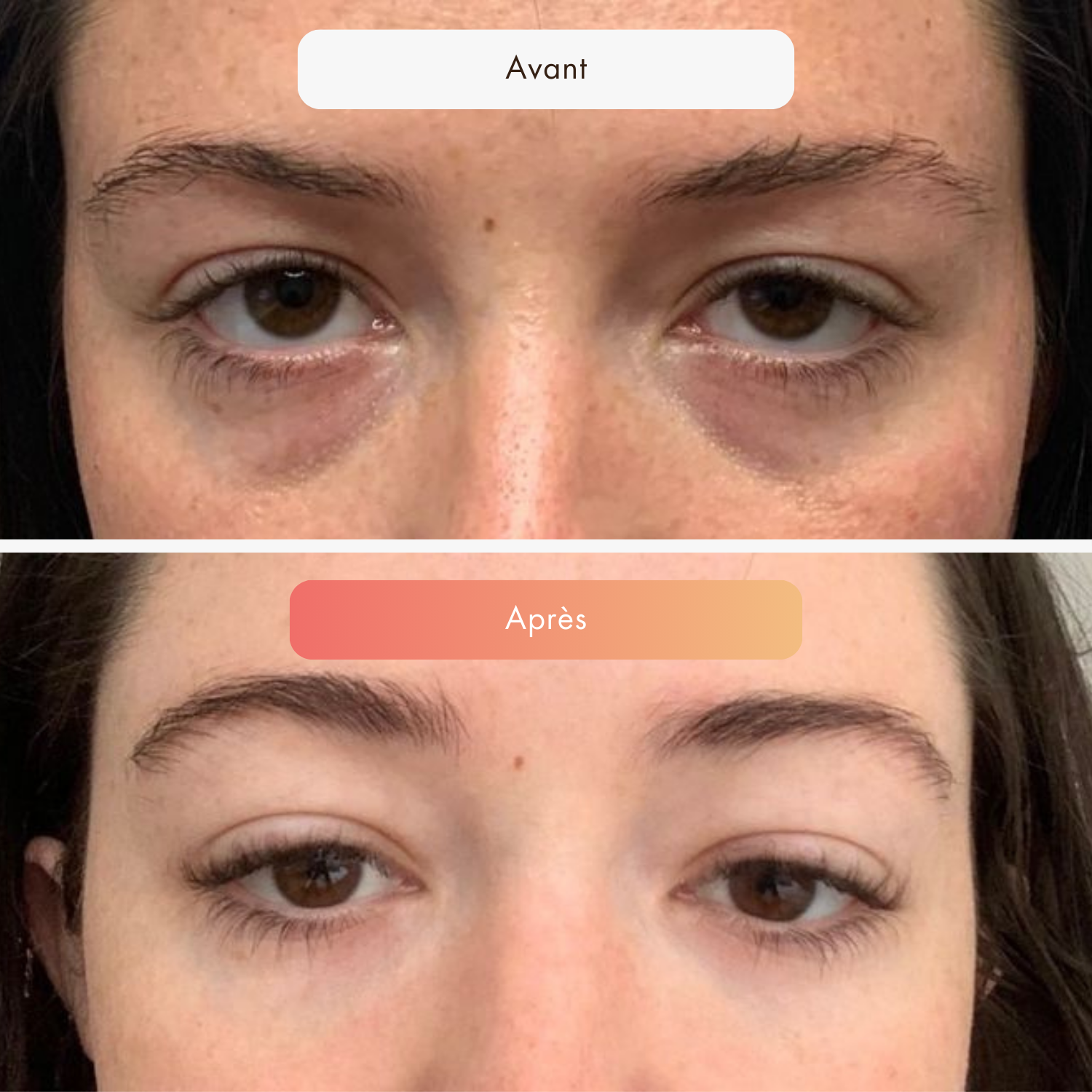 AvantApres_29.png