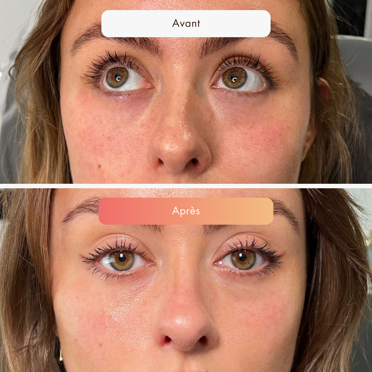 AvantApres_30.png